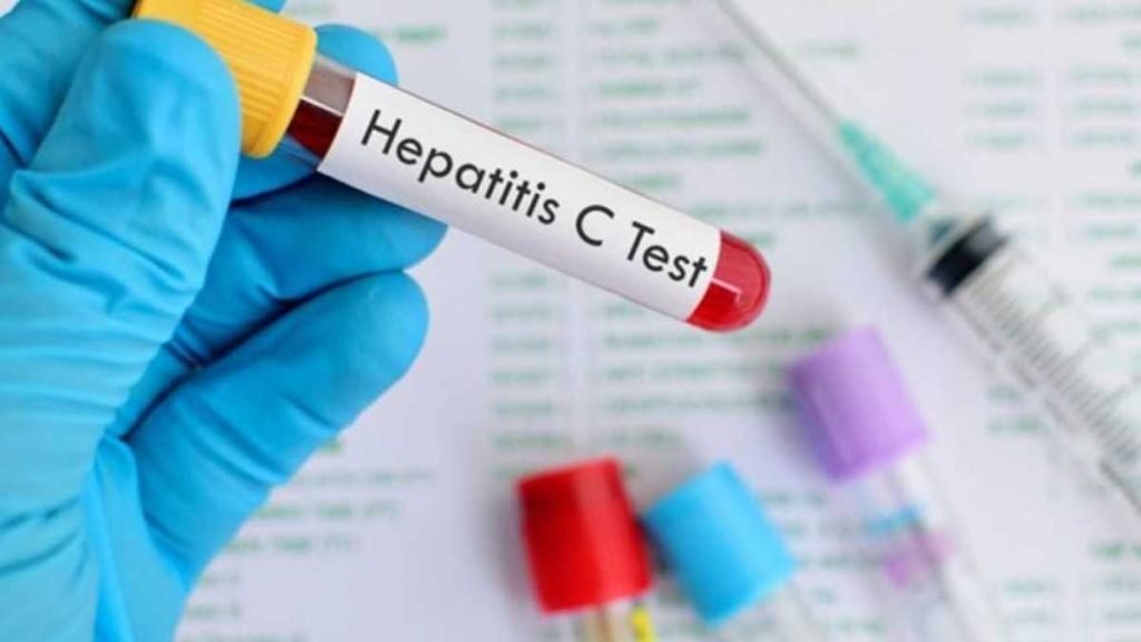 OMS alerta que la nueva hepatitis es un tema “muy urgente”