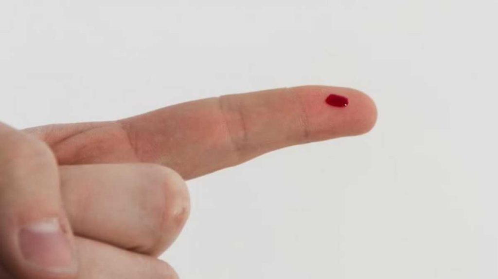 Crean prueba para detectar infartos con solo una gota de sangre